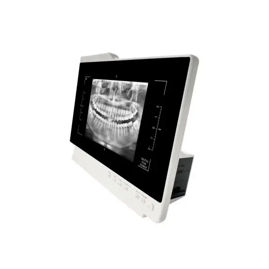 Câmera intraoral com monitor 2 em 1